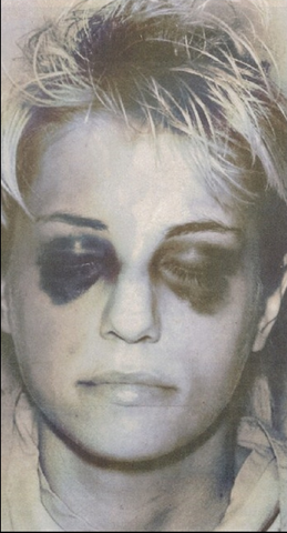 File:Homolka black eyes.png