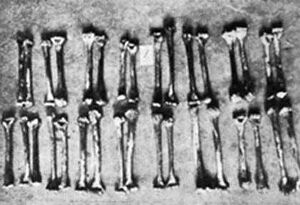 Haarmann Bones