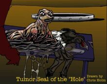 Tumor Seal-1