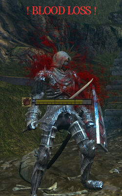 Blood loss02.jpg