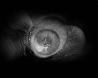 Syringe and eye