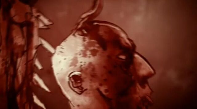 File:Jones infection.jpg