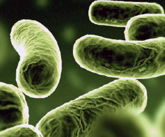 File:Vibrio cholerae.jpg