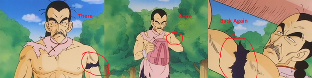 File:Updated Missing Arm Band.png