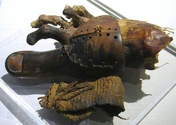 Prosthetic toe