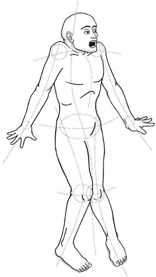 Startle-pattern-or-reflex-and-how-to-prevent-it-with-the-alexander-technique