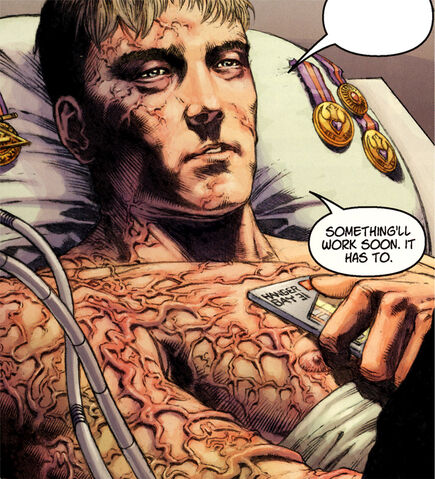 Archivo:Hobbie-diseased.jpg