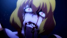 She lose her teeth