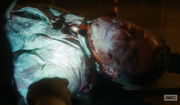 Melvin, close to death