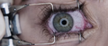 Thumbnail for version as of 09:35, March 22, 2012