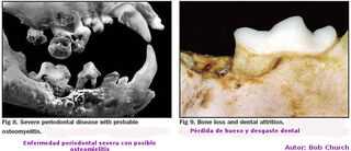 Dientes15.jpg