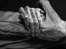 Mummified body