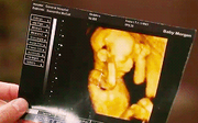 DannyUltrasoundpic1