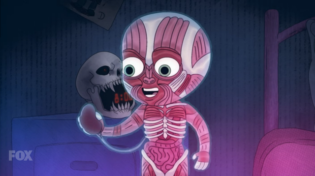 File:Dylan has a kidney disorder.png