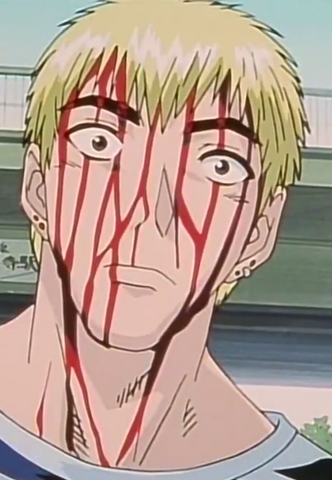 File:Bloodied Onizuka.png