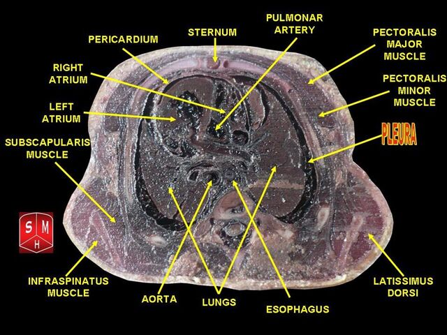 File:Thorax section 3.jpg