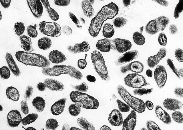 File:Coxiella burnetii 01.jpg