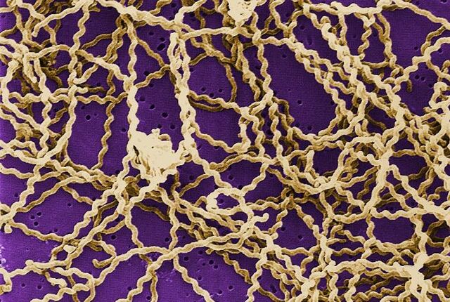 File:Leptospira scanning micrograph.jpg