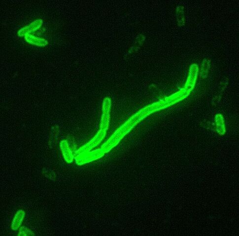 File:606px-Yersinia pestis fluorescent.jpeg