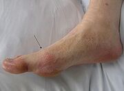 220px-Gout2010