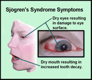 Sjogrens.jpg