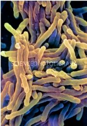 Tuberculose1.jpg