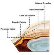 Glaucoma2