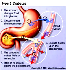 Arquivo:Fisiopatologia.jpg