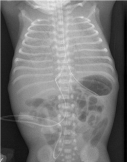 Resp.Neonato 1.jpg