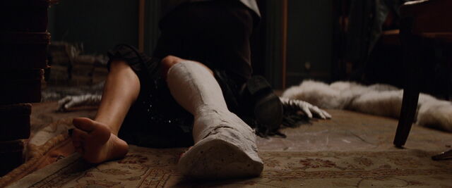 File:Bridget's open cast leg.jpg