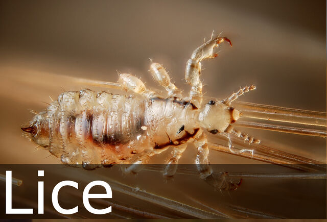 File:Lice caption.jpg