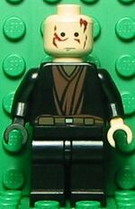 Anakin Skywalker burned