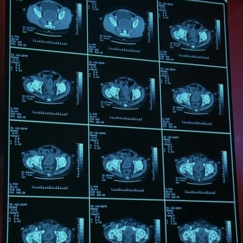File:3x07ctscanslide.jpg