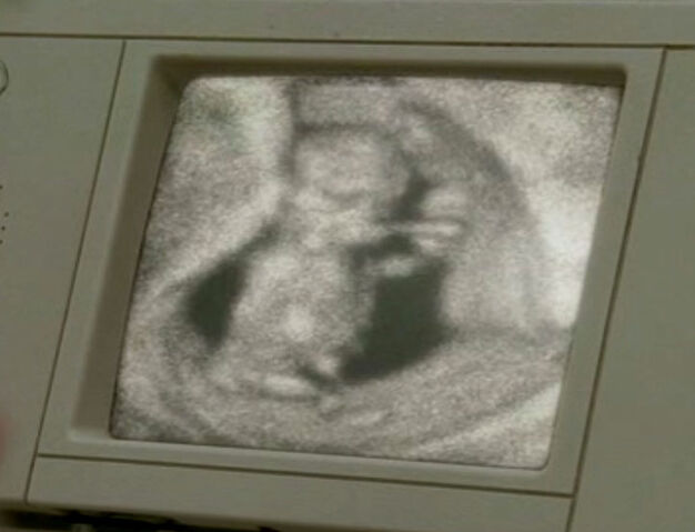Ficheiro:Ultrasound-1-.jpg
