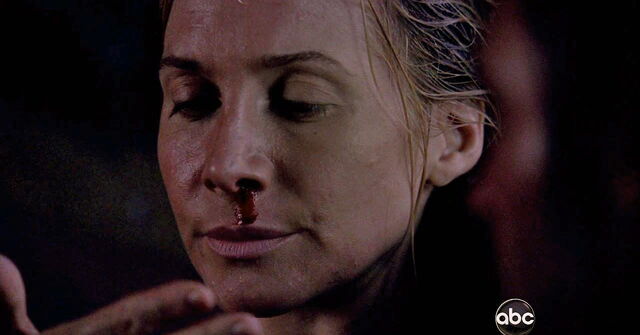 File:5x04 Juliet'sBleedingNose.jpg