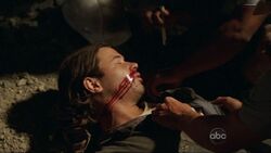 5x01-arbeiter-verletzt2.jpg