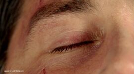 Jacks-eye-shut