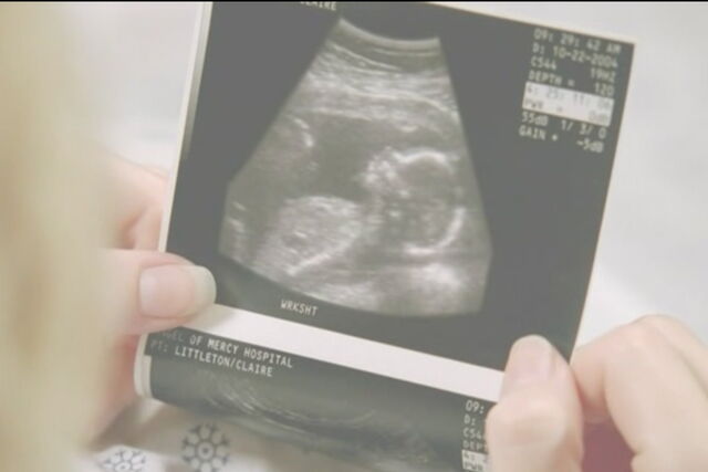 File:Aaronultrasound.jpg