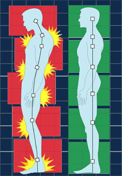 Posture & pain