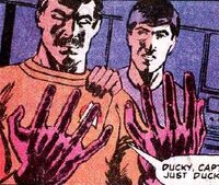 Scotty's injured hands