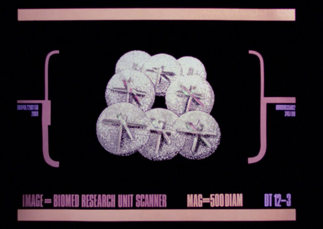 File:Microbrain scan while reproducing.jpg