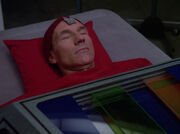 Picard during surgery.jpg