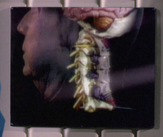 File:Parasitic being attached to Quinn.jpg