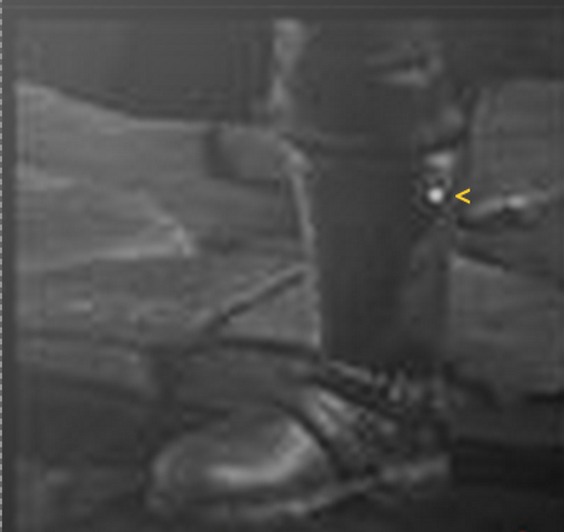 File:E6c49-1-.png