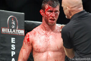 Hess bloody