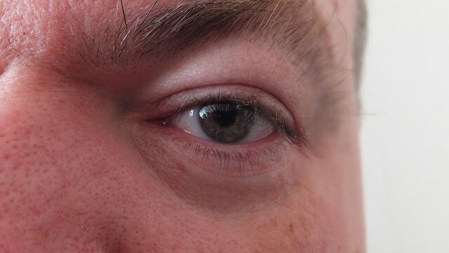 File:Eye-140980 960 720.jpg