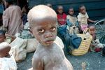 Lovia - Rwandan refugee boy in Goma