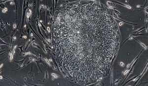 04-celule-ips