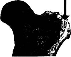 File:70823-any2fbimgloader37.jpeg