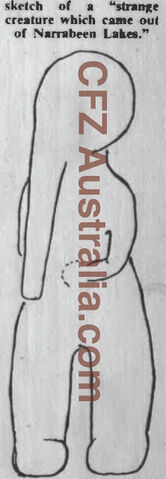 File:Elephantman4.jpg